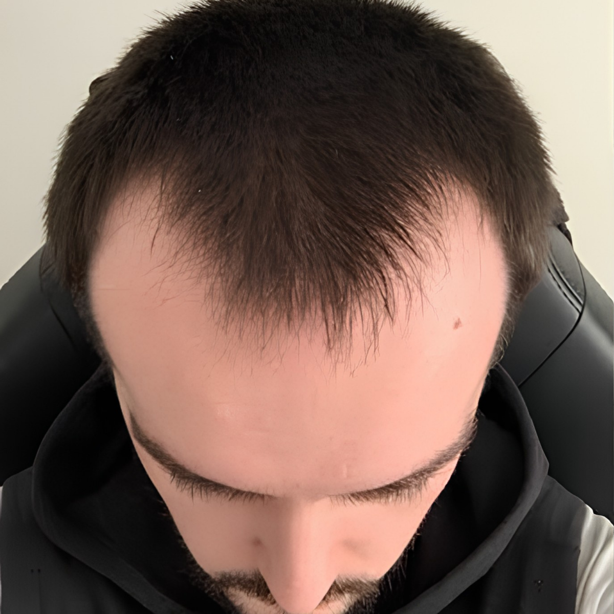 Before