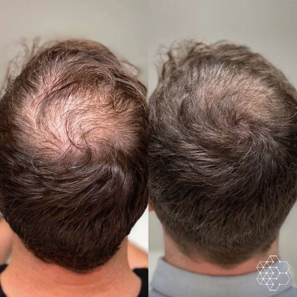 Feature product image
