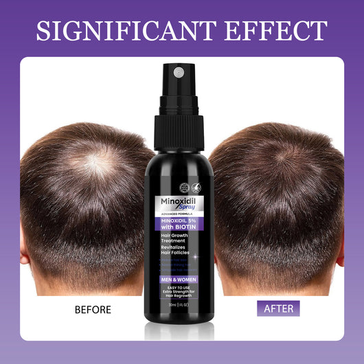 NuHair™ Minoxidil + Biotin Regrowth Formula